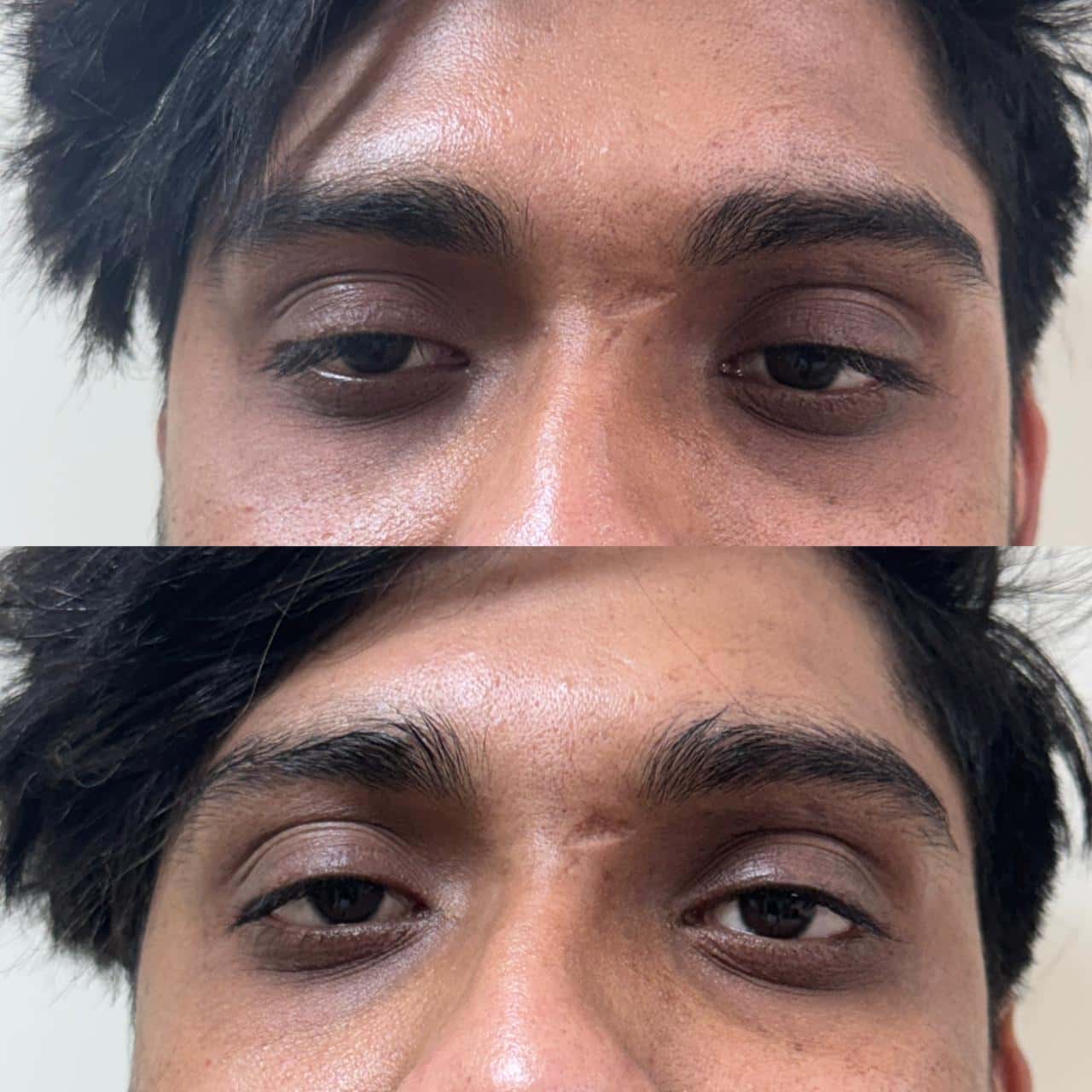 Black Doll Facial Result