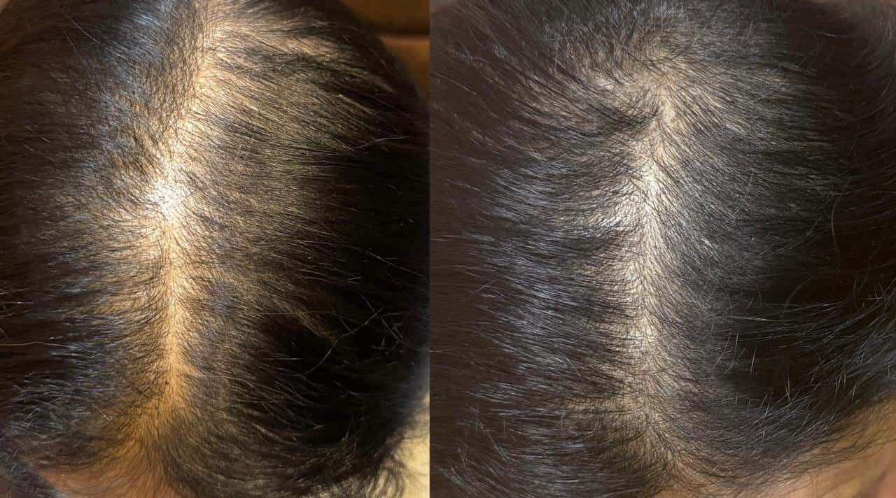 Hair GFC Result 2